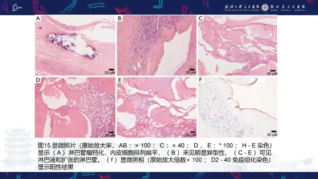 影像PPT - 【PPT】肾上腺常见病变CT及MRI诊断-27