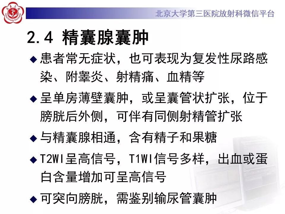 影像PPT - 【PPT】射精管-精囊区梗阻性无精子症-19