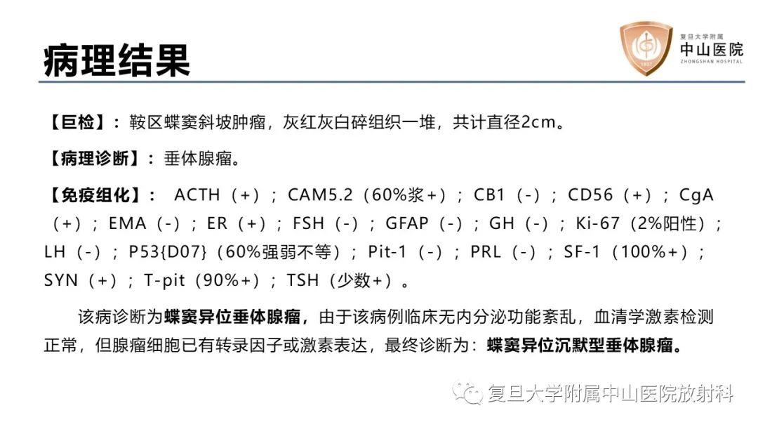 影像PPT - 【病例】蝶窦异位垂体腺瘤1例CT及MR-12