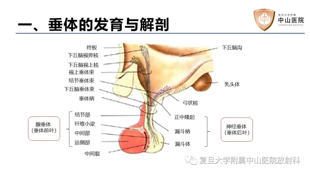 影像PPT - 【病例】蝶窦异位垂体腺瘤1例CT及MR-14