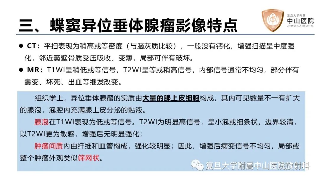 影像PPT - 【病例】蝶窦异位垂体腺瘤1例CT及MR-21