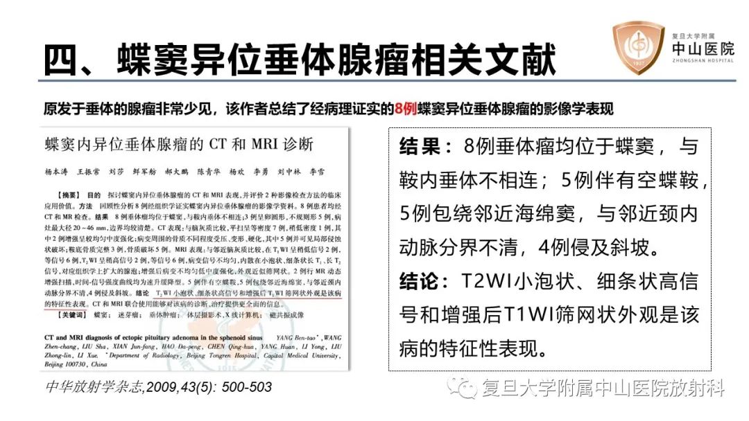 影像PPT - 【病例】蝶窦异位垂体腺瘤1例CT及MR-23