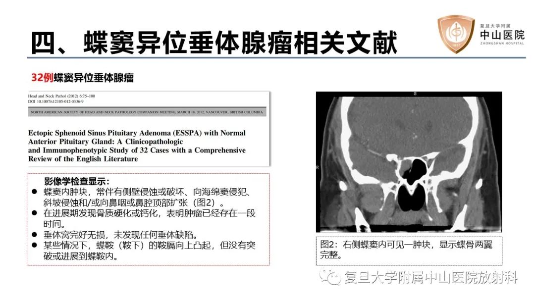 影像PPT - 【病例】蝶窦异位垂体腺瘤1例CT及MR-24