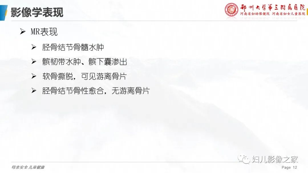 影像PPT - 【PPT】胫骨结节骨软骨炎的影像诊断-12