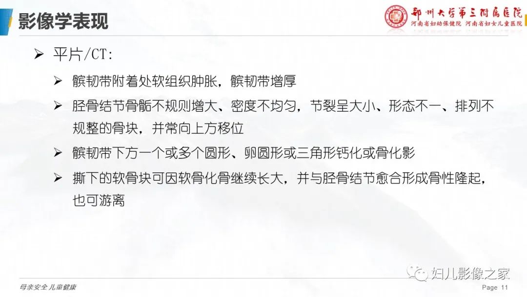 影像PPT - 【PPT】胫骨结节骨软骨炎的影像诊断-11