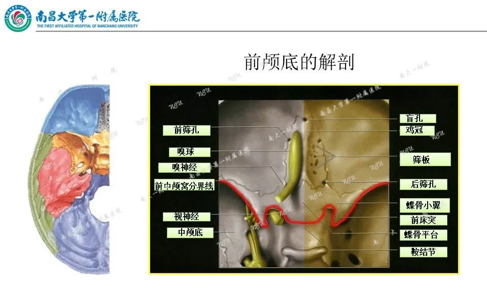 影像PPT - 【PPT】颅底肿瘤的影像诊断思路-12