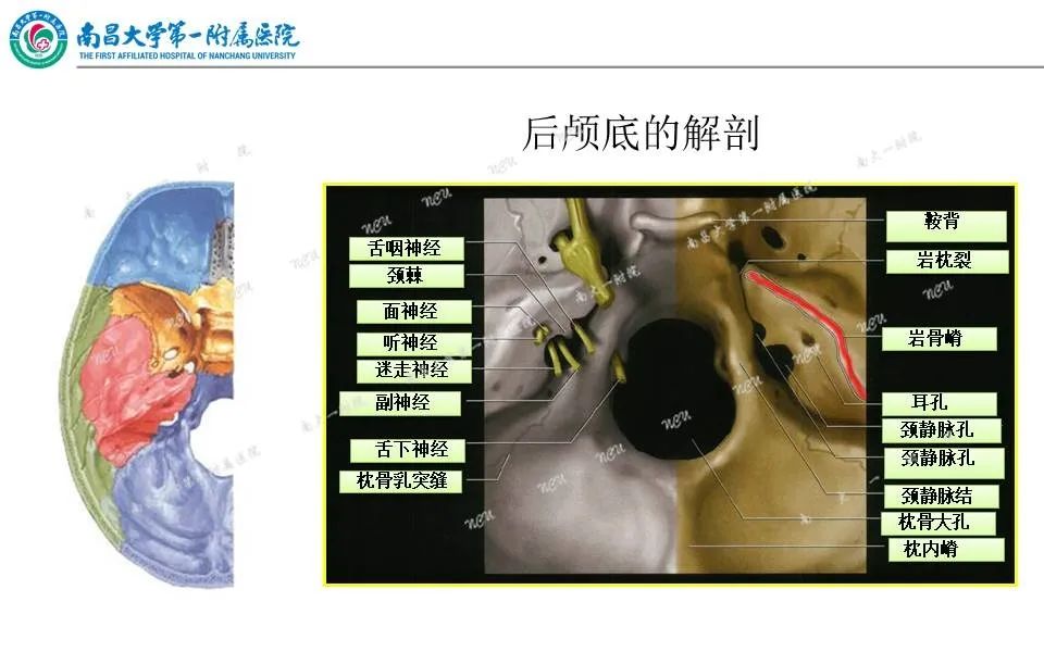 影像PPT - 【PPT】颅底肿瘤的影像诊断思路-14