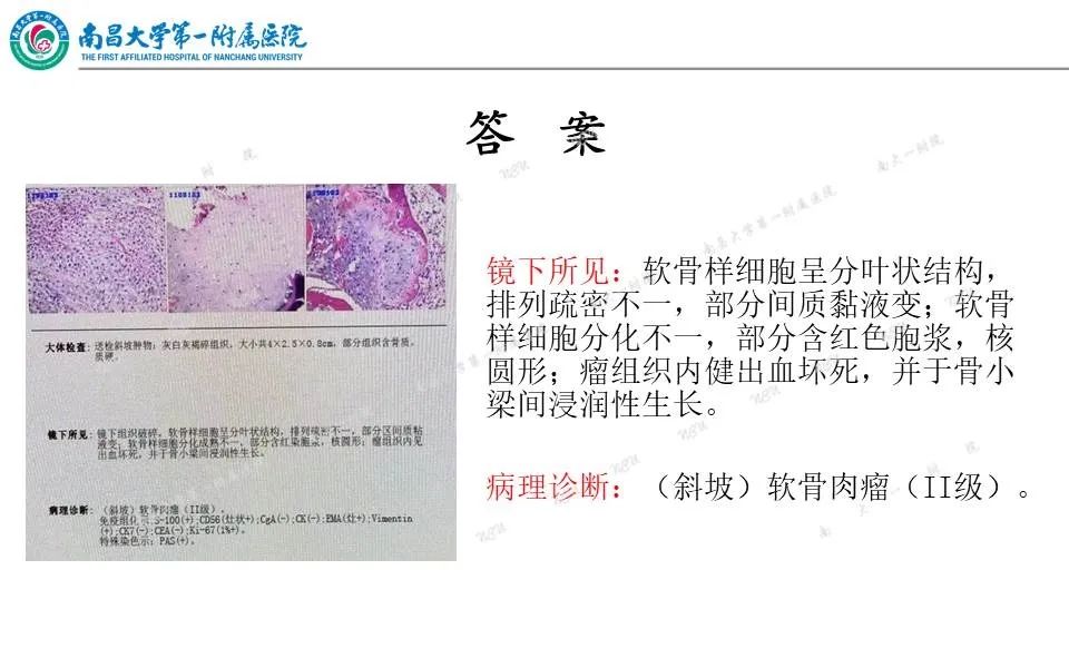 影像PPT - 【PPT】颅底肿瘤的影像诊断思路-8