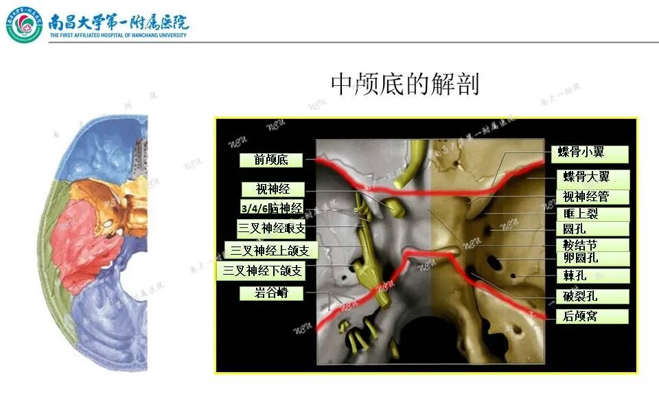 影像PPT - 【PPT】颅底肿瘤的影像诊断思路-13