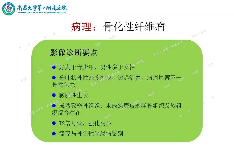 影像PPT - 【PPT】颅底肿瘤的影像诊断思路-26