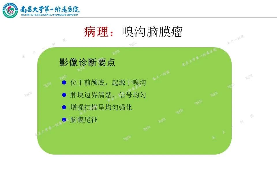 影像PPT - 【PPT】颅底肿瘤的影像诊断思路-28