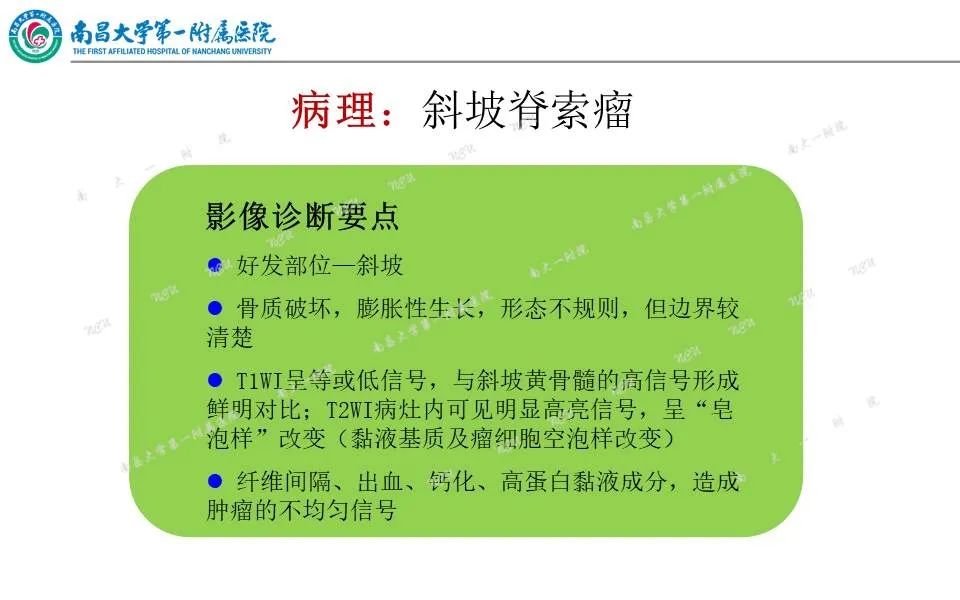 影像PPT - 【PPT】颅底肿瘤的影像诊断思路-30