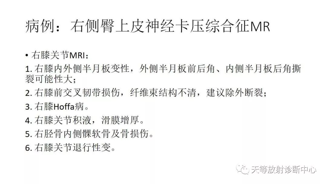 影像PPT - 【PPT】坐骨-股骨撞击综合征-29