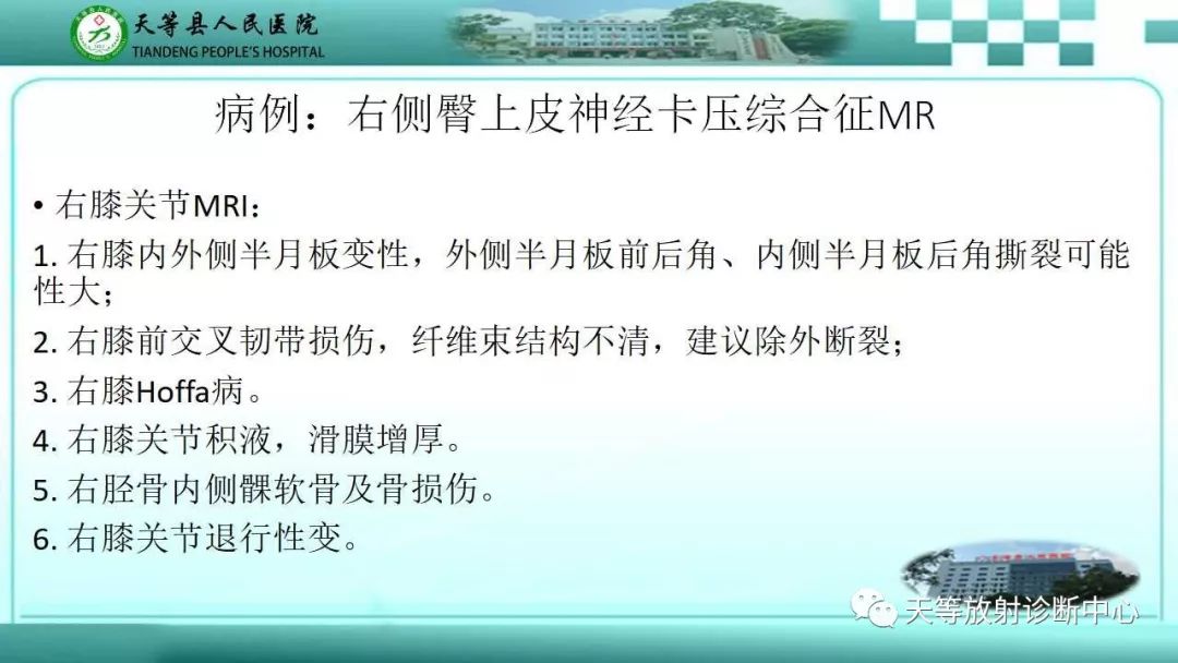 影像PPT - 【PPT】臀中肌损伤-15