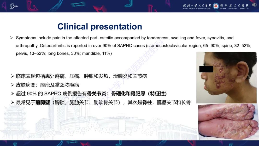 影像PPT - 【PPT】SAPHO综合征影像诊断-9