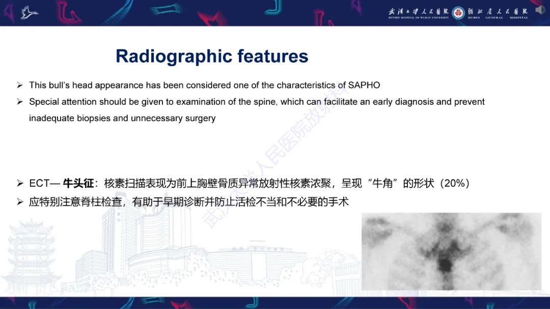 影像PPT - 【PPT】SAPHO综合征影像诊断-13
