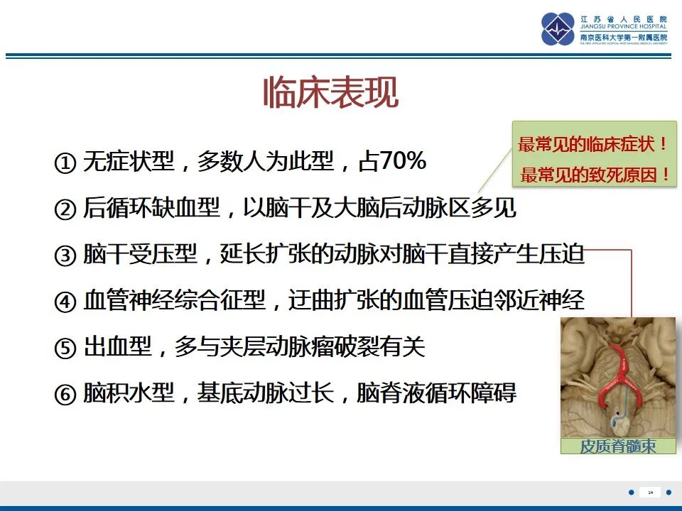 影像PPT - 【PPT】椎基底动脉延长扩张症-25
