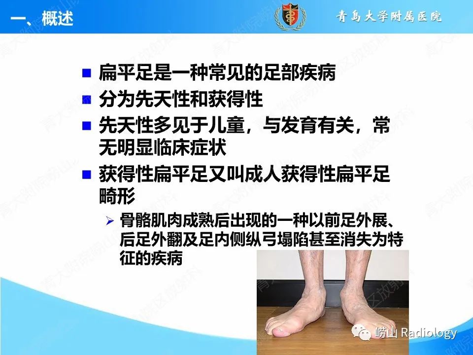 影像PPT - 【PPT】成人获得性扁平足（ AAFD ）及其相关损伤的影像诊断-3