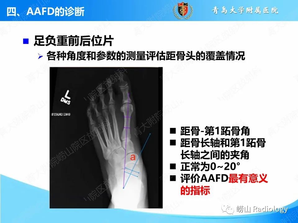 影像PPT - 【PPT】成人获得性扁平足（ AAFD ）及其相关损伤的影像诊断-14