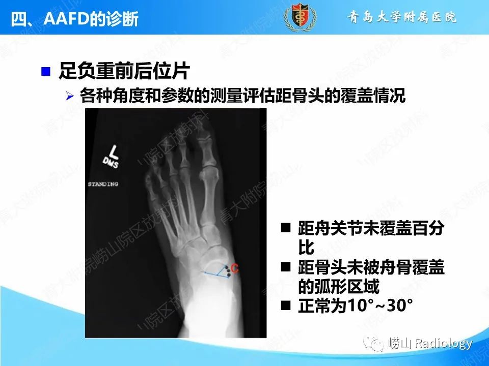 影像PPT - 【PPT】成人获得性扁平足（ AAFD ）及其相关损伤的影像诊断-16