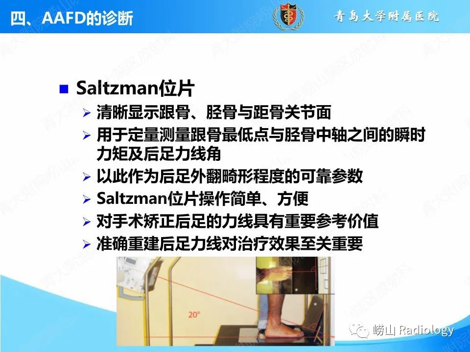 影像PPT - 【PPT】成人获得性扁平足（ AAFD ）及其相关损伤的影像诊断-21