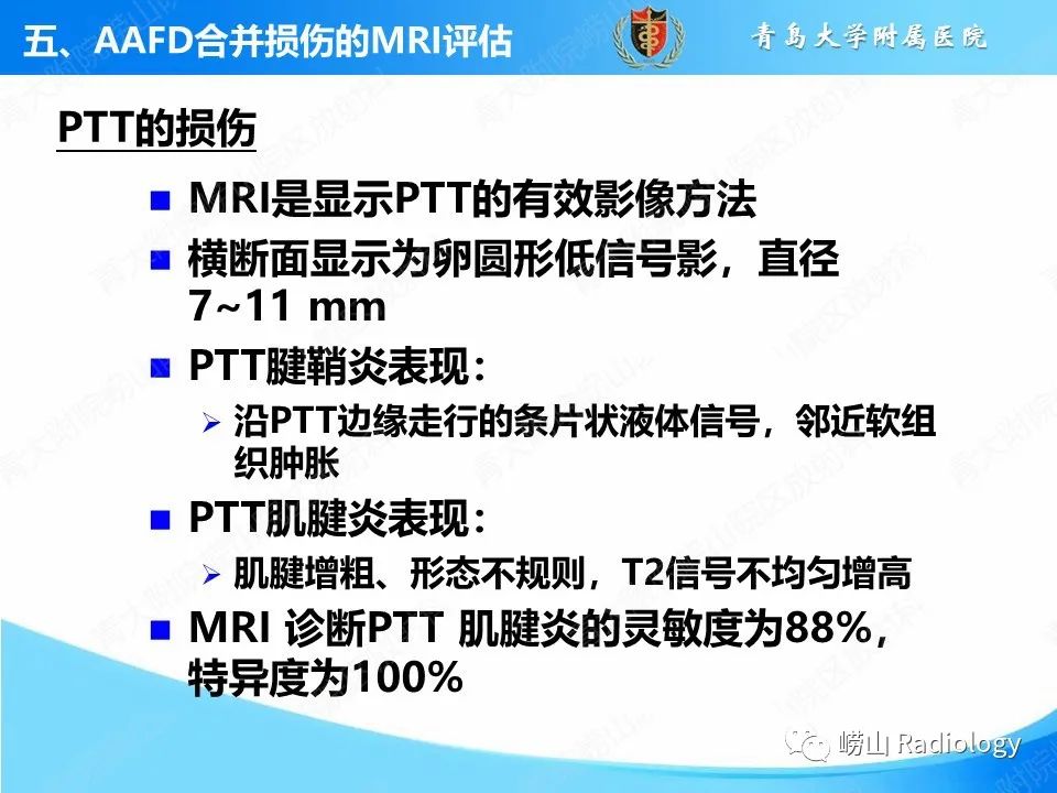 影像PPT - 【PPT】成人获得性扁平足（ AAFD ）及其相关损伤的影像诊断-28