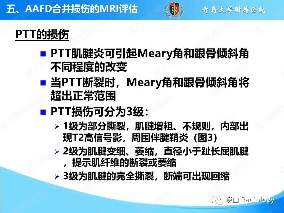 影像PPT - 【PPT】成人获得性扁平足（ AAFD ）及其相关损伤的影像诊断-29