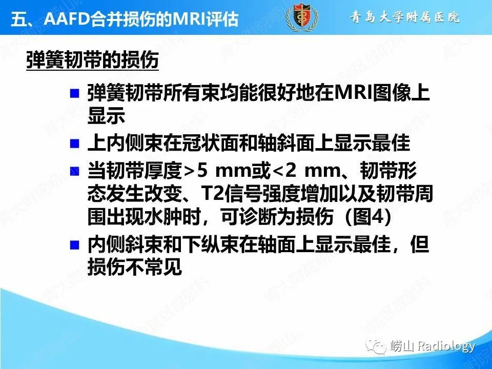 影像PPT - 【PPT】成人获得性扁平足（ AAFD ）及其相关损伤的影像诊断-33