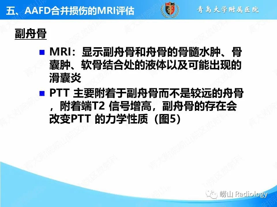 影像PPT - 【PPT】成人获得性扁平足（ AAFD ）及其相关损伤的影像诊断-36