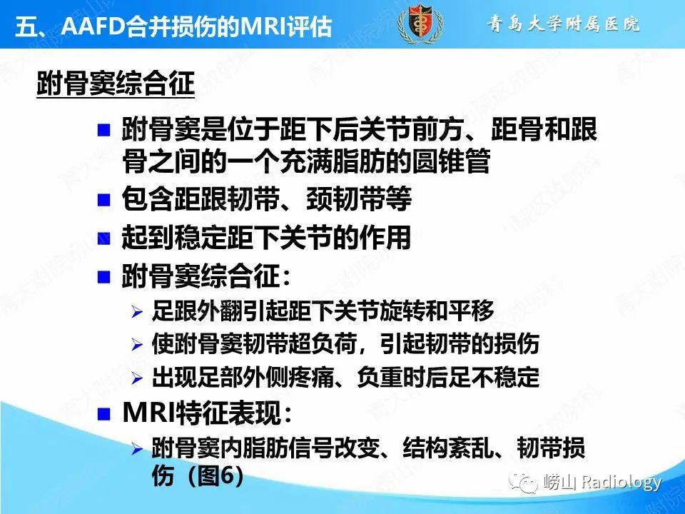 影像PPT - 【PPT】成人获得性扁平足（ AAFD ）及其相关损伤的影像诊断-38