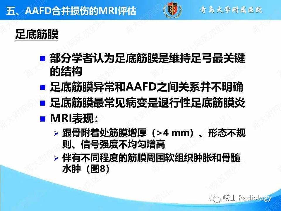 影像PPT - 【PPT】成人获得性扁平足（ AAFD ）及其相关损伤的影像诊断-44