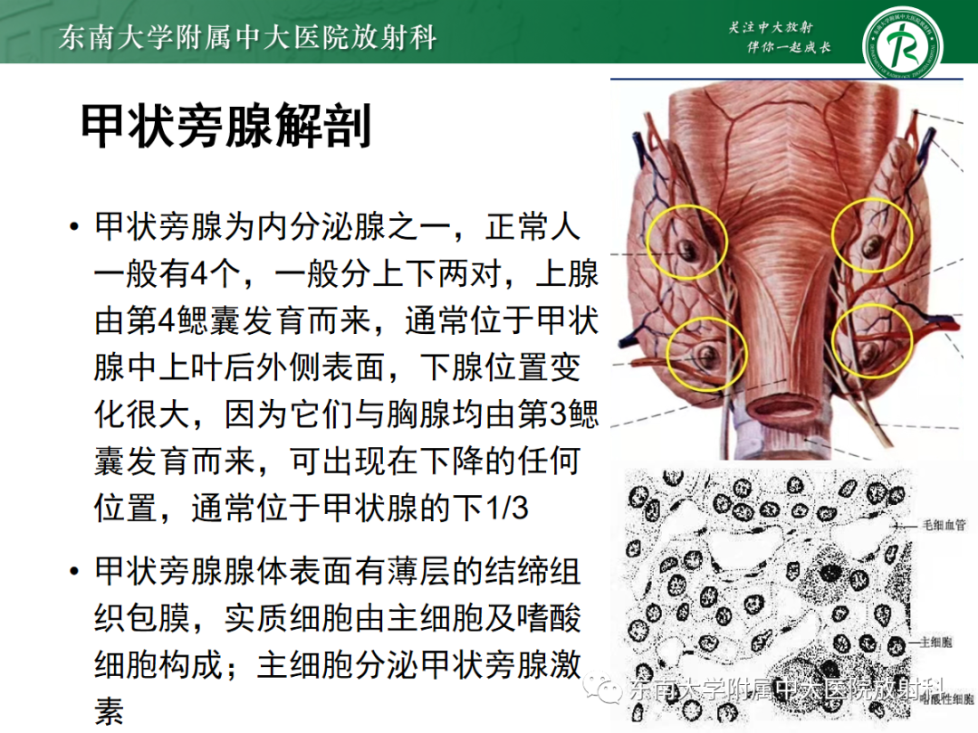 影像PPT - 【PPT】原发性甲状旁腺功能亢进-10 影像PPT - 【PPT】原发性甲状旁腺功能亢进-10