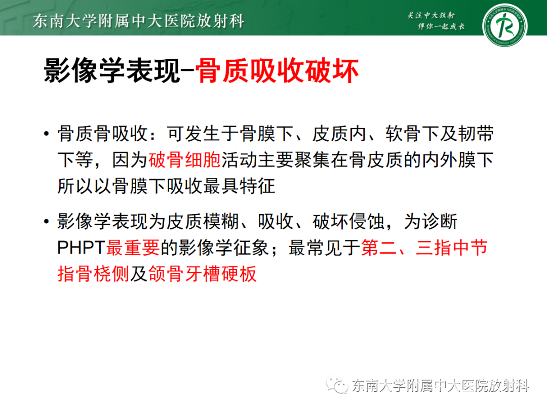 影像PPT - 【PPT】原发性甲状旁腺功能亢进-21 影像PPT - 【PPT】原发性甲状旁腺功能亢进-21