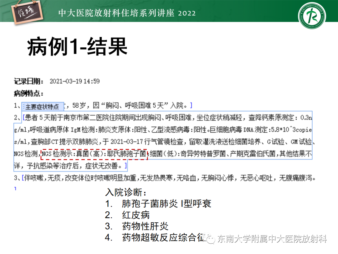 影像PPT - 【PPT】胸部病例读片——蝶翼征-6