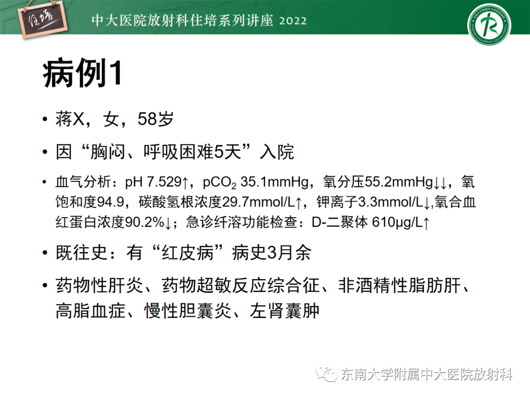 影像PPT - 【PPT】胸部病例读片——蝶翼征-2