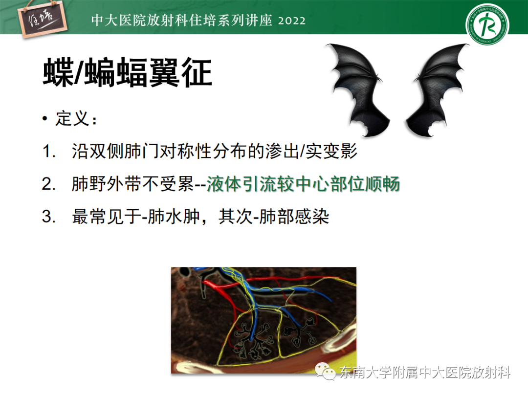 影像PPT - 【PPT】胸部病例读片——蝶翼征-12