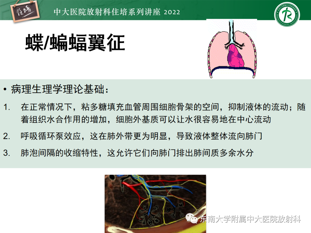影像PPT - 【PPT】胸部病例读片——蝶翼征-13