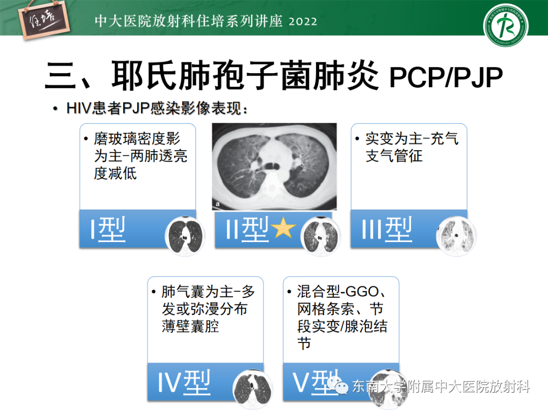 影像PPT - 【PPT】胸部病例读片——蝶翼征-22