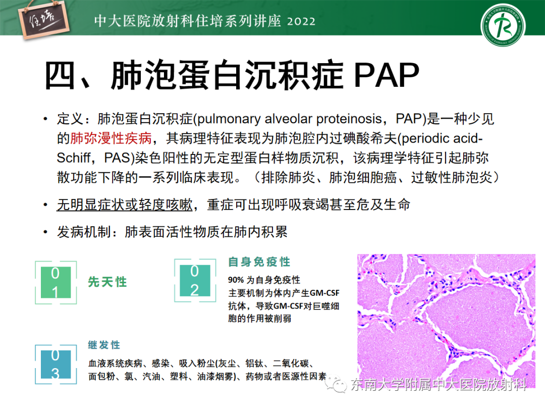 影像PPT - 【PPT】胸部病例读片——蝶翼征-29
