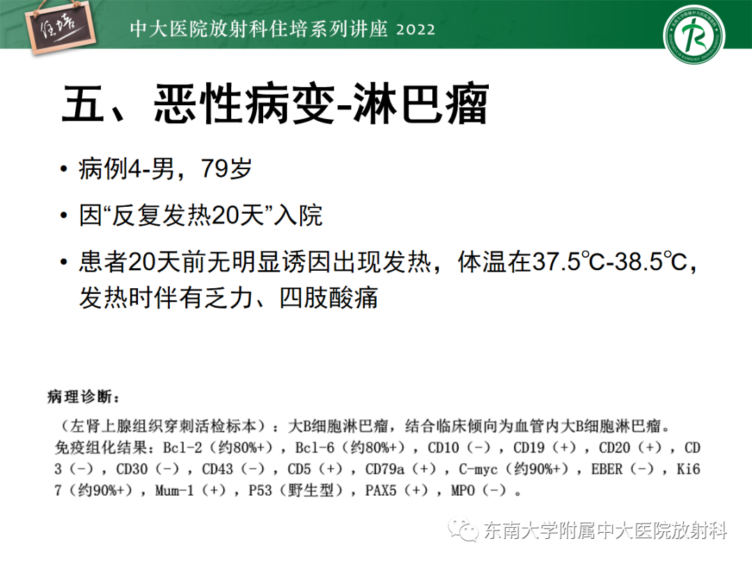 影像PPT - 【PPT】胸部病例读片——蝶翼征-33