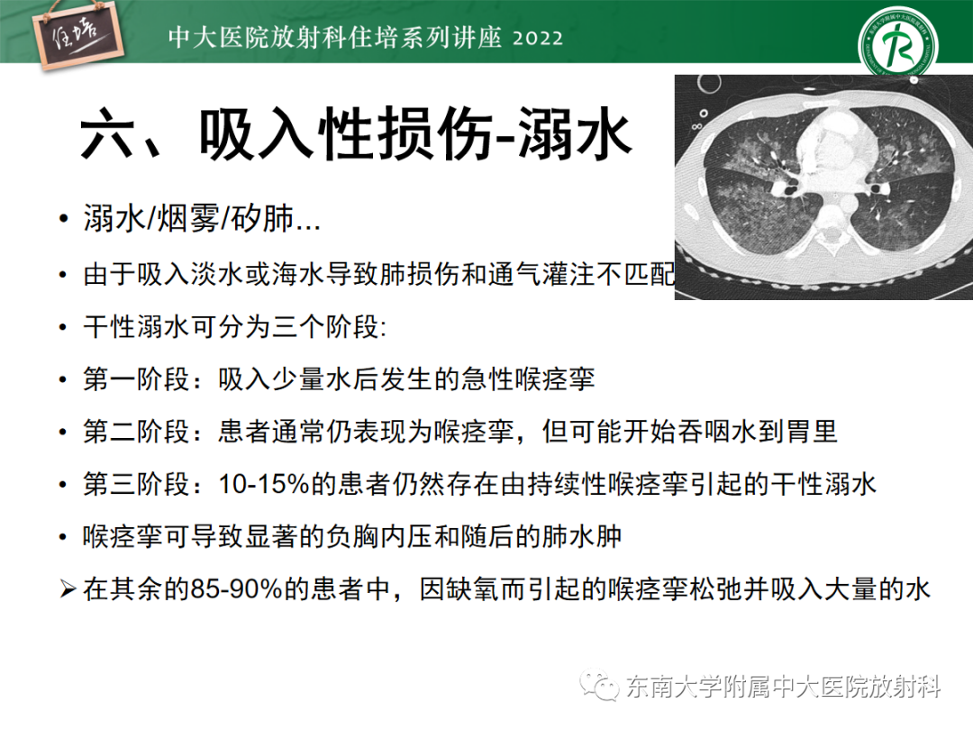 影像PPT - 【PPT】胸部病例读片——蝶翼征-39
