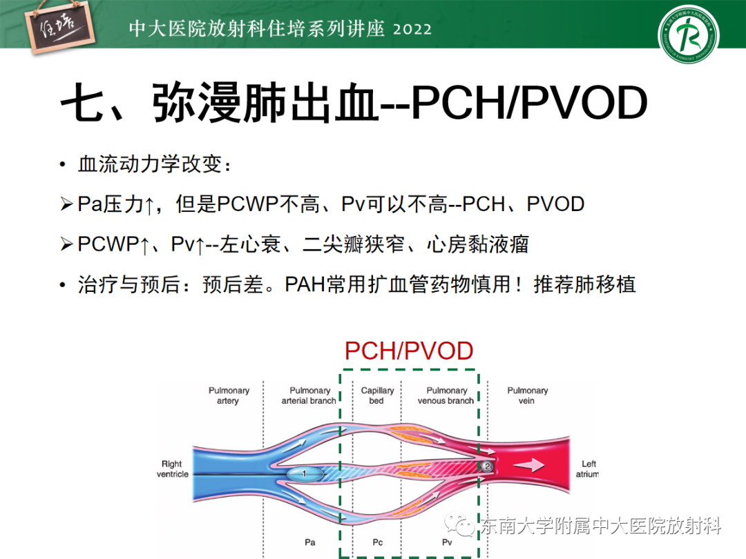影像PPT - 【PPT】胸部病例读片——蝶翼征-45