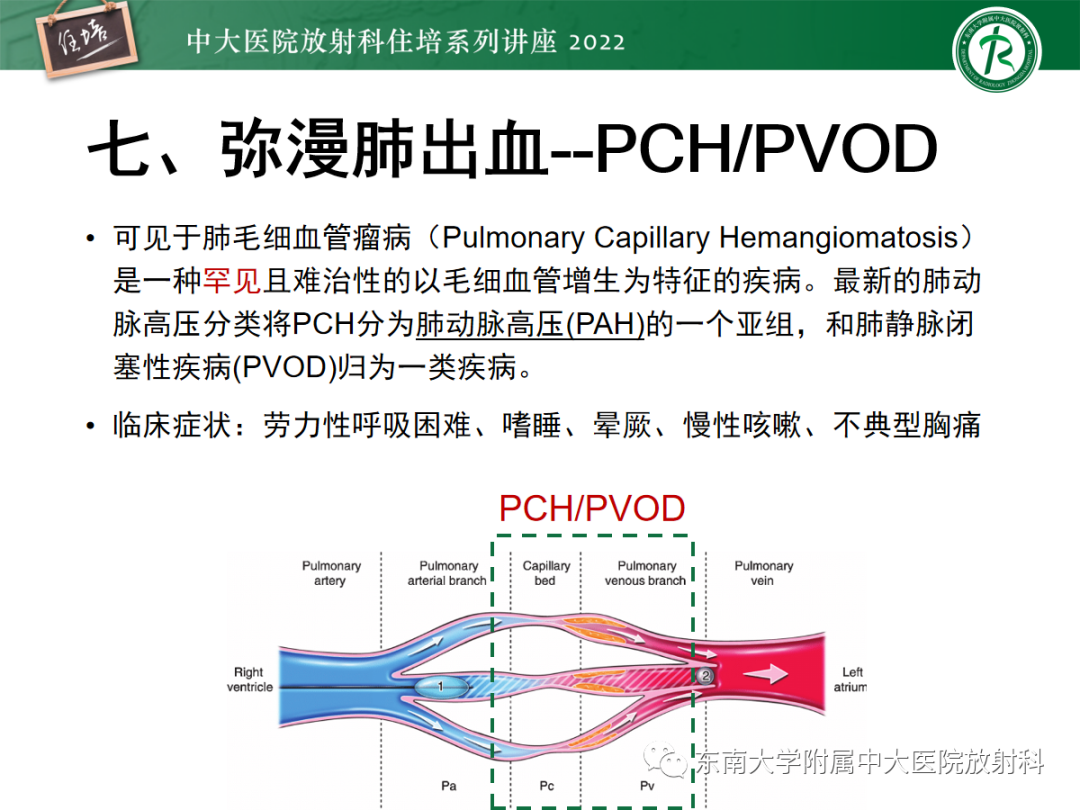 影像PPT - 【PPT】胸部病例读片——蝶翼征-44