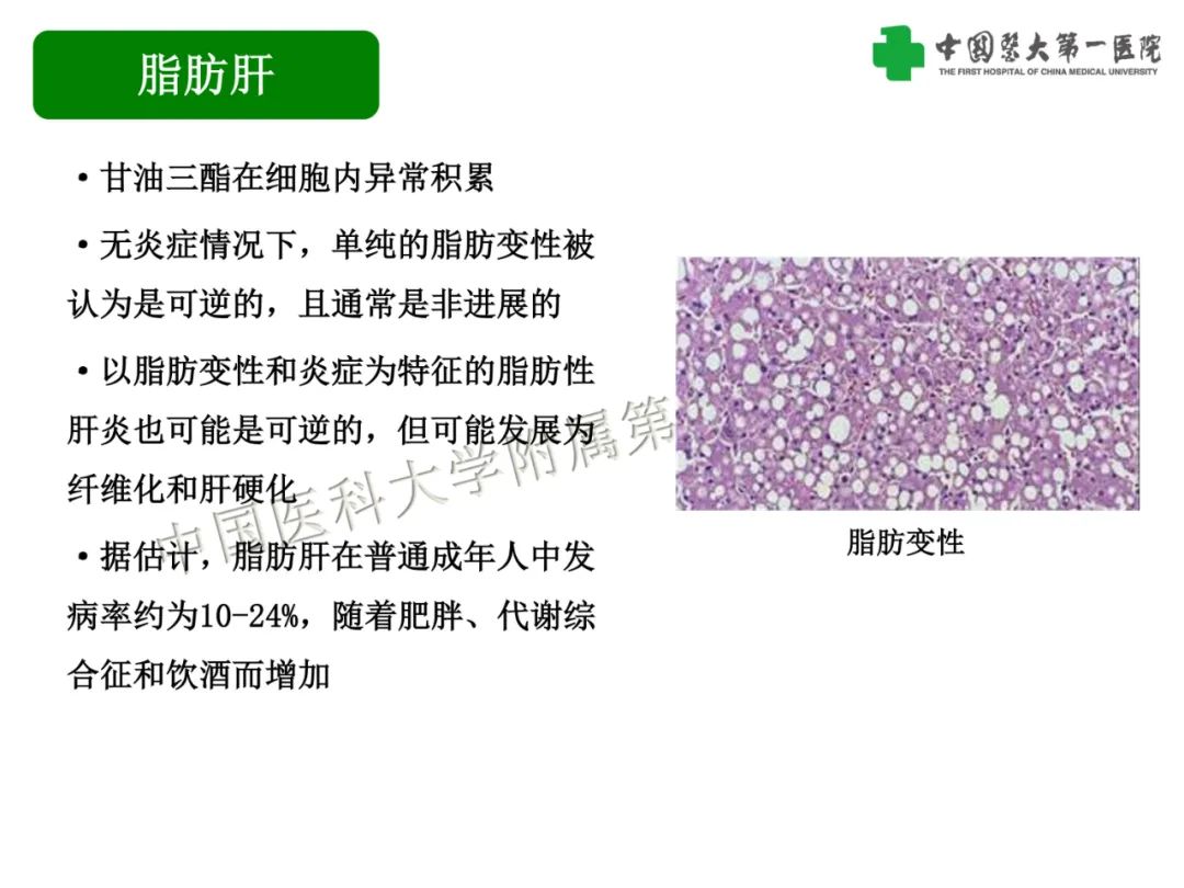 影像PPT - 【PPT】是脂是敌？肝脏良性含脂病变与相似的恶性病变鉴别诊断-3