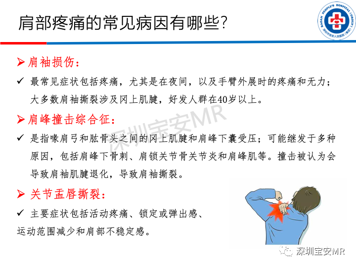 影像PPT - 【PPT】肩关节磁共振检查-2