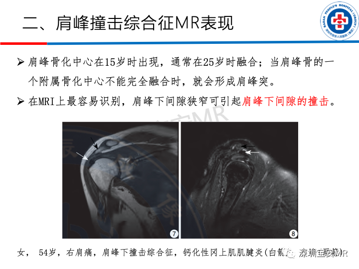 影像PPT - 【PPT】肩关节磁共振检查-9