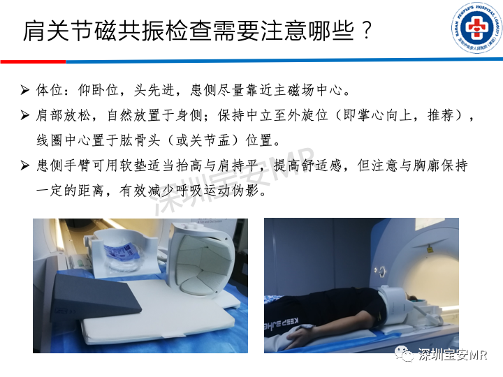影像PPT - 【PPT】肩关节磁共振检查-5
