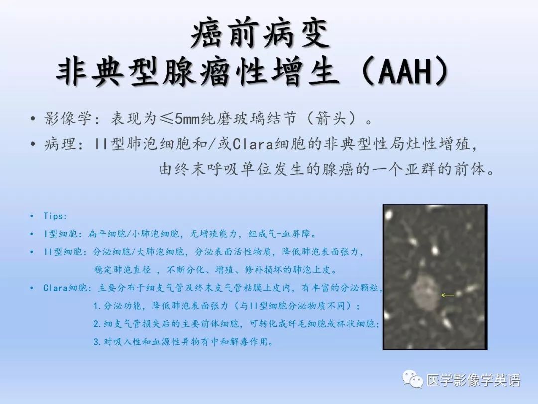 影像PPT - 【PPT】肺腺癌TNM分期影像学解读-4