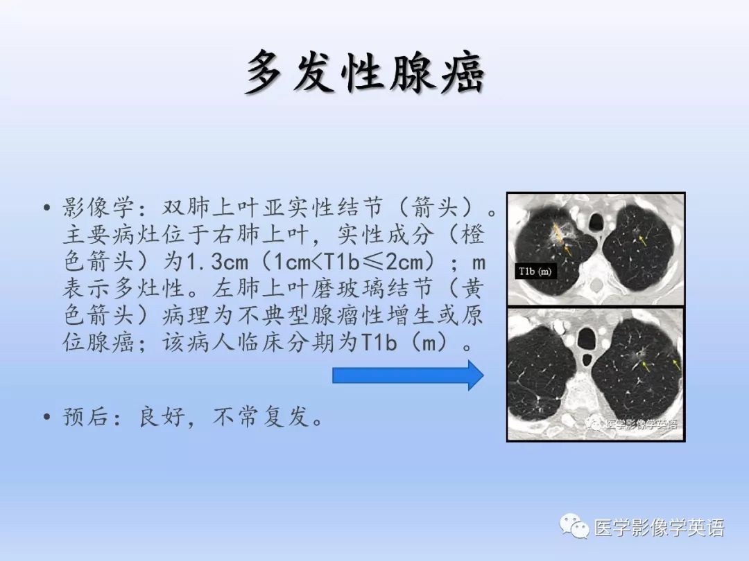 影像PPT - 【PPT】肺腺癌TNM分期影像学解读-18