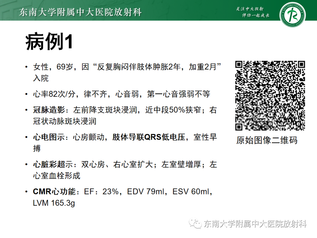 影像PPT - 【PPT】心肌淀粉样变-1